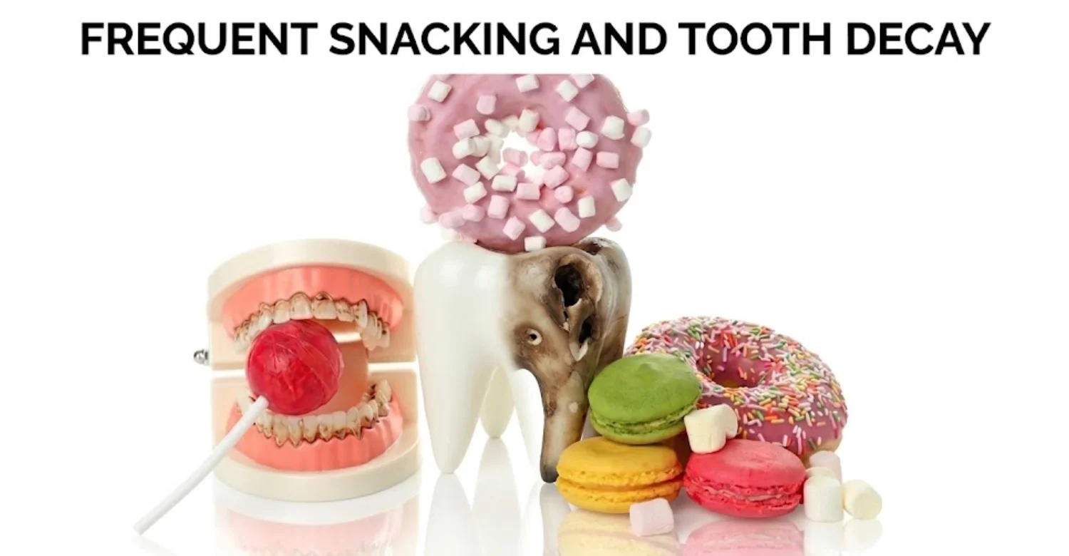 Frequent snacking and its effect on teeth